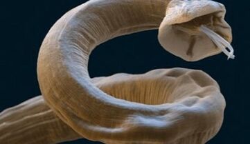 Παράσιτο Ascaris στο ανθρώπινο σώμα
