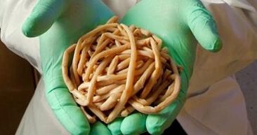 παράσιτα που εξάγονται από το ανθρώπινο σώμα