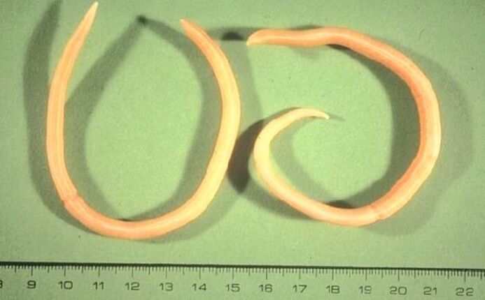 pinworm από το ανθρώπινο σώμα