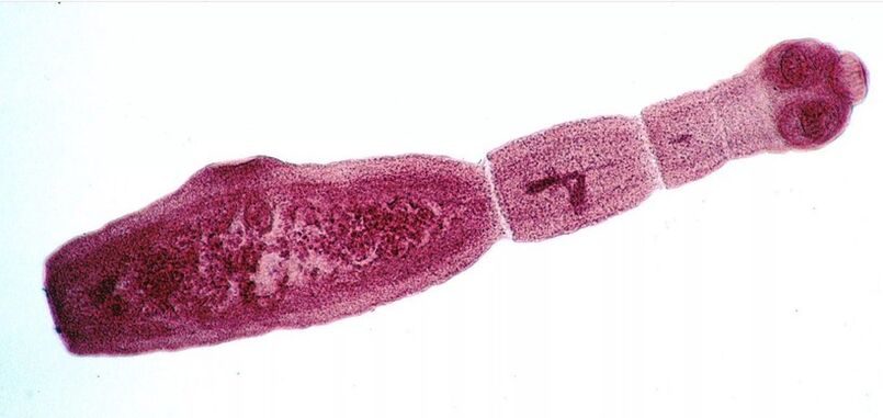 Το Echinococcus είναι ένα από τα πιο επικίνδυνα παράσιτα για τον άνθρωπο