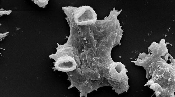Η Negleria fowlera είναι ένα πρωτόζωο παράσιτο επικίνδυνο για την ανθρώπινη ζωή. 