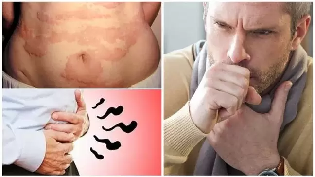 Οι αλλεργίες, ο βήχας και το φούσκωμα είναι σημάδια βλάβης στο σώμα από τα σκουλήκια